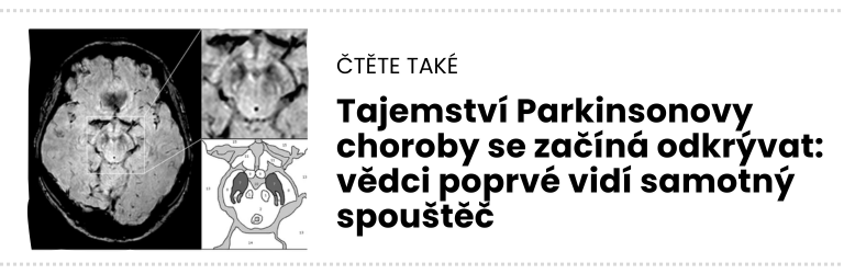 čTĚTE TAKÉ (11)